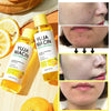 Some By Mi Yuja Niacin 30 Days Miracle Brightening Toner